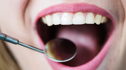 Revisión dental de encías y dientes sanos en clínica de odontología general